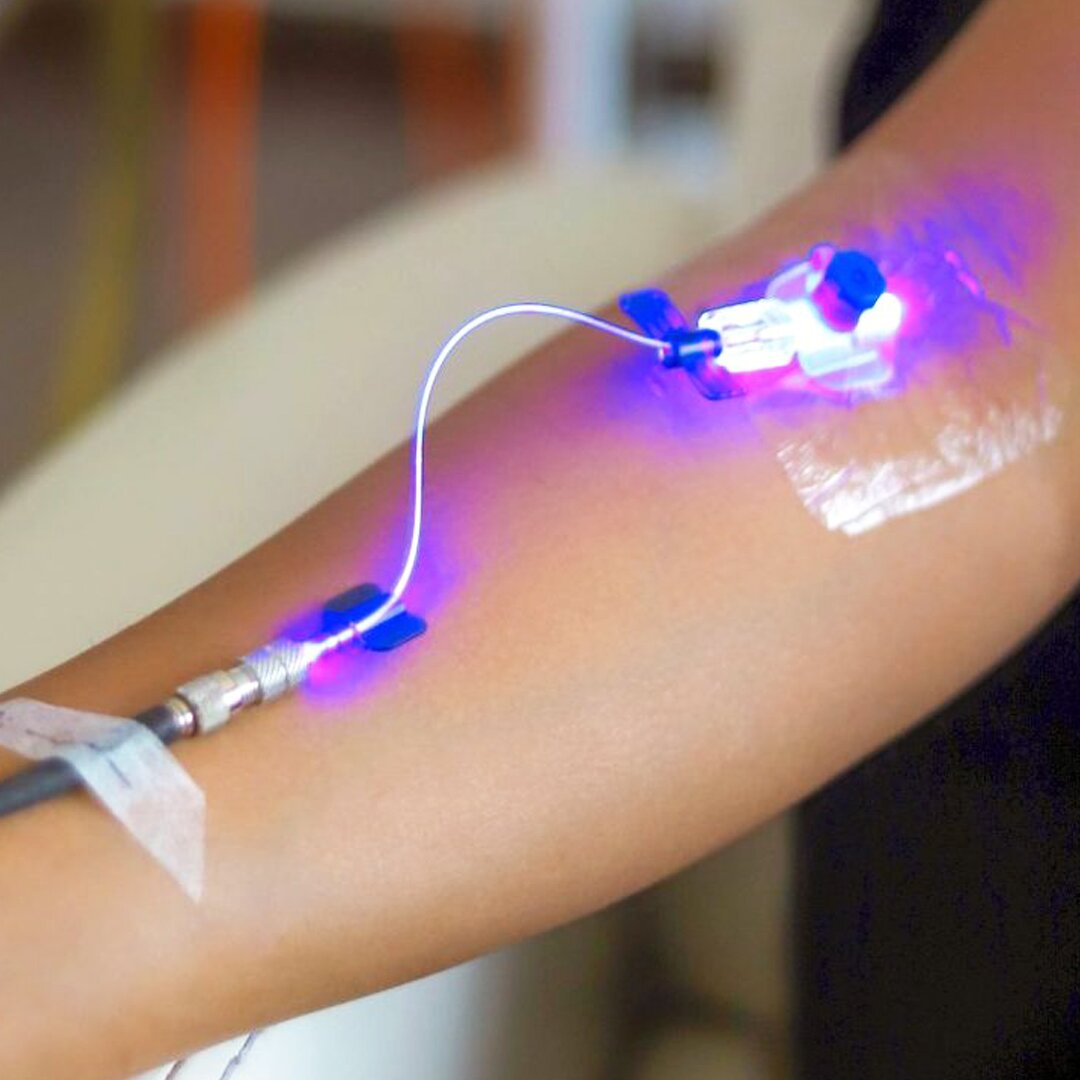 Laser nội tĩnh mạch tại Phòng khám Đông y Minh Nguyệt Nhân Hòa Đường