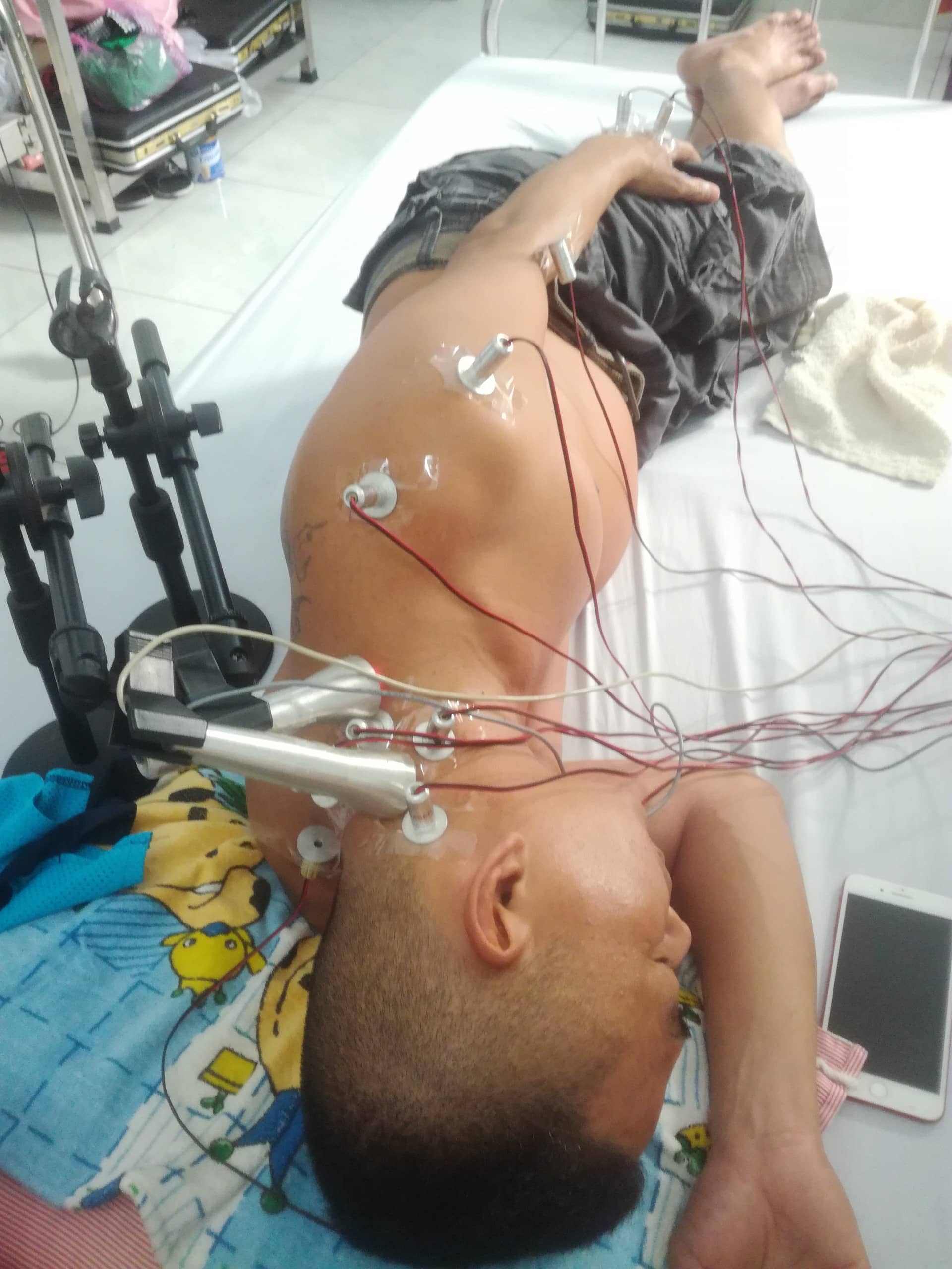 Điều trị đau vai gáy bằng laser châm quang châm quang trị liệu tại Phòng khám Đông y Minh Nguyệt Nhân Hòa Đường