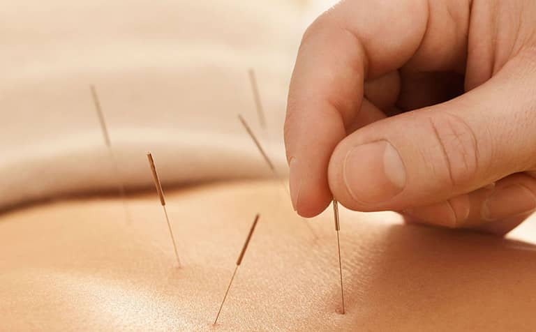 Phương pháp châm cứu trong khám đông y Châm cứu ngày càng được sử dụng phổ biến trong chăm sóc sức khỏe, bao gồm điều trị căng thẳng.