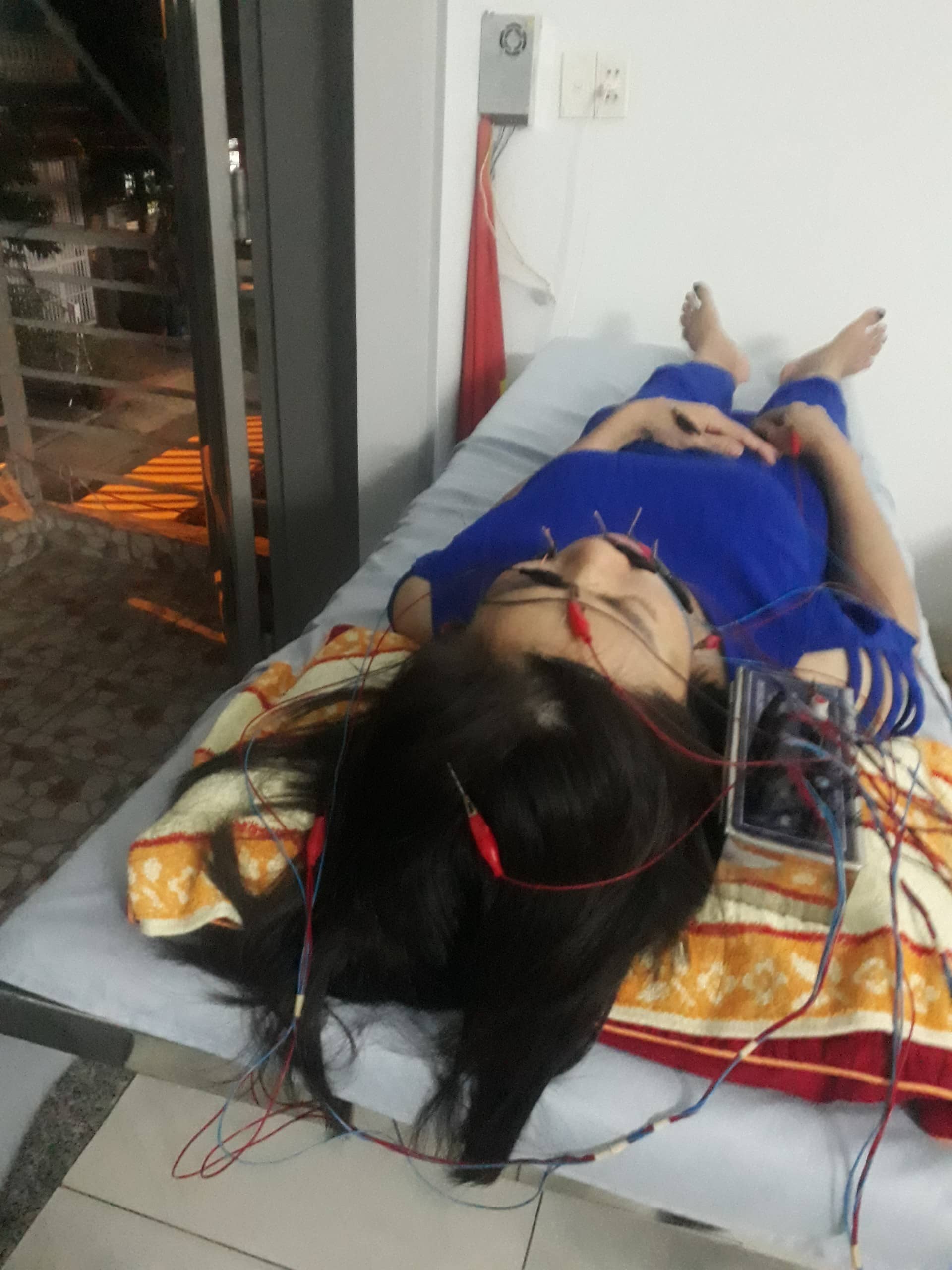Châm cứu đôngy điện châm tại phòng khám đông y Minh Nguyệt Nhân Hoà Đường