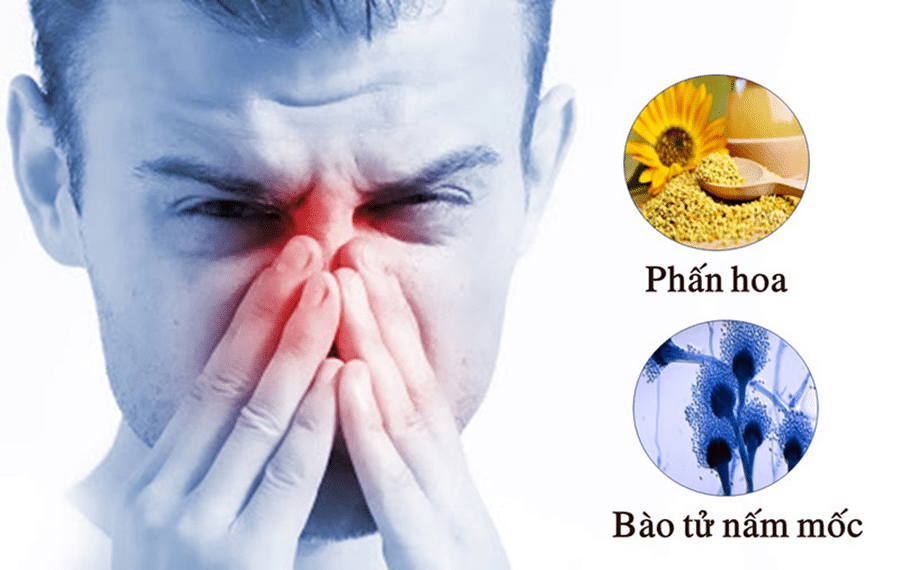 nguyên nhân bệnh viêm mũi dị ứng