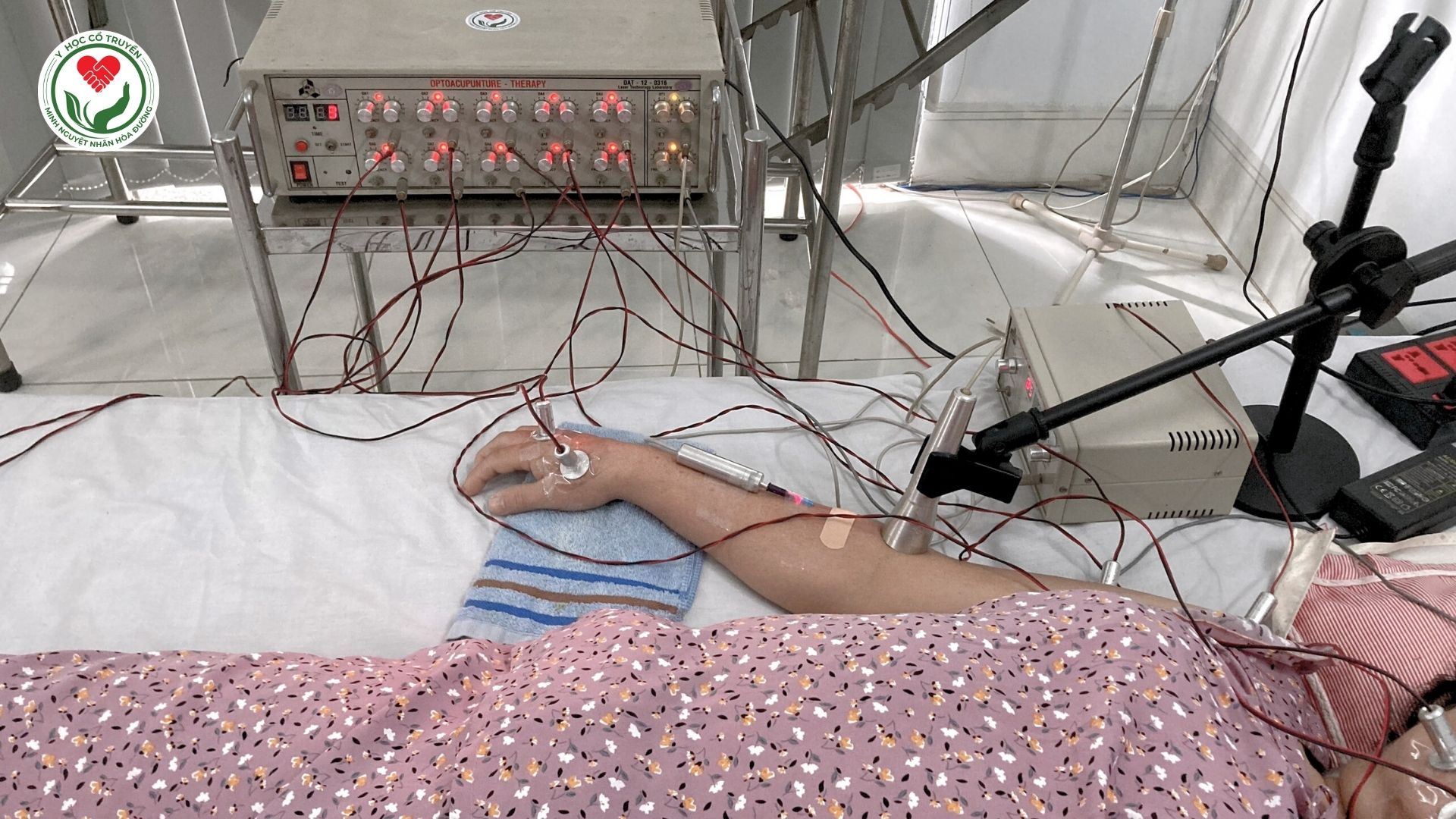 Điều trị bệnh nhân sau tai biến mạch máu não bằng thiết bị Quang châm Quang trị liệu và Laser Nội tĩnh mạch
