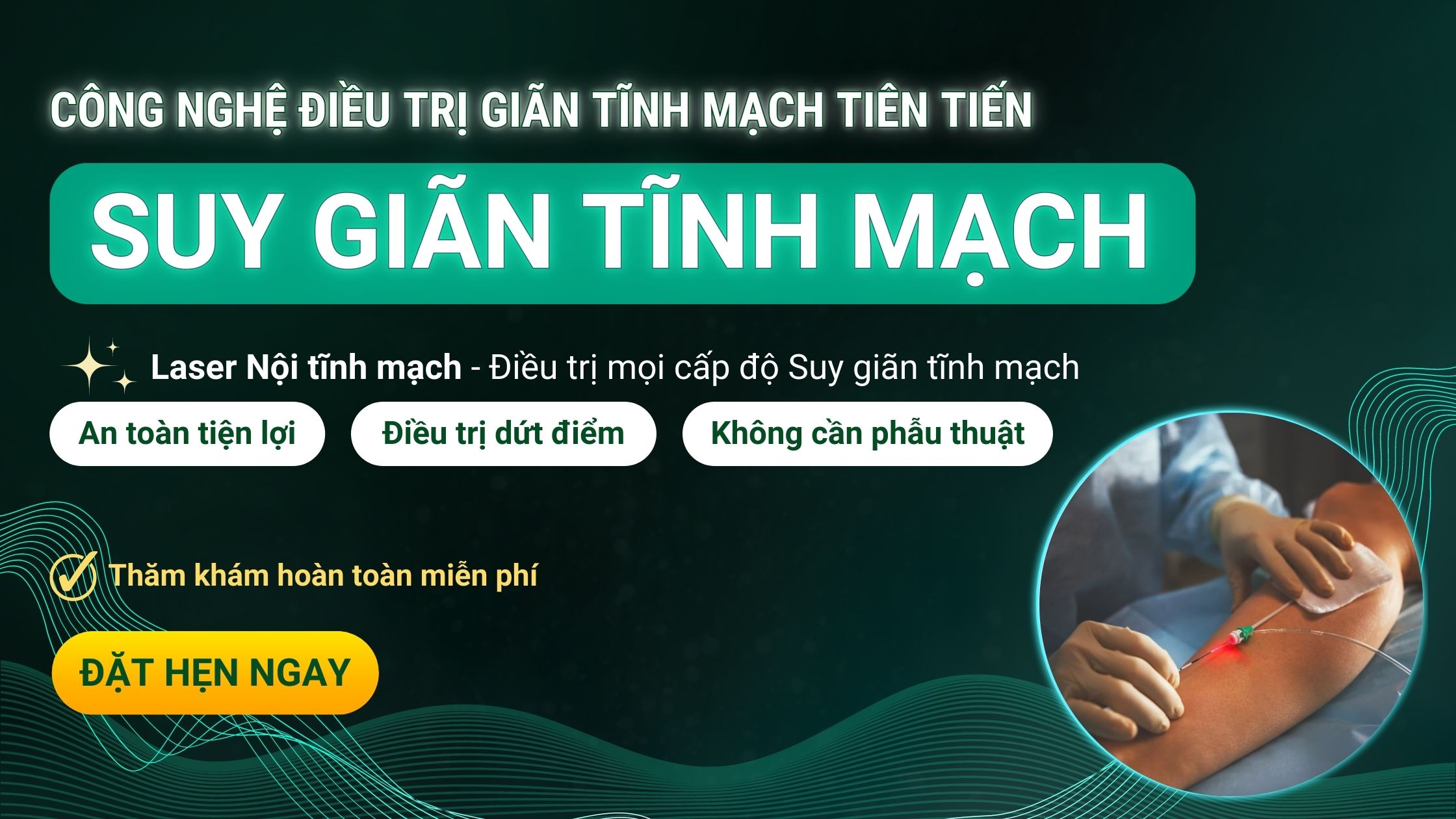 Điều trị Giãn tĩnh mạch bằng Laser Nội tĩnh mạch