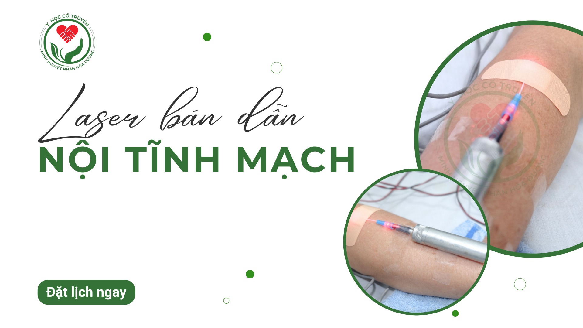 Laser Nội tĩnh mạch Laser bán dẫn công suất thấp