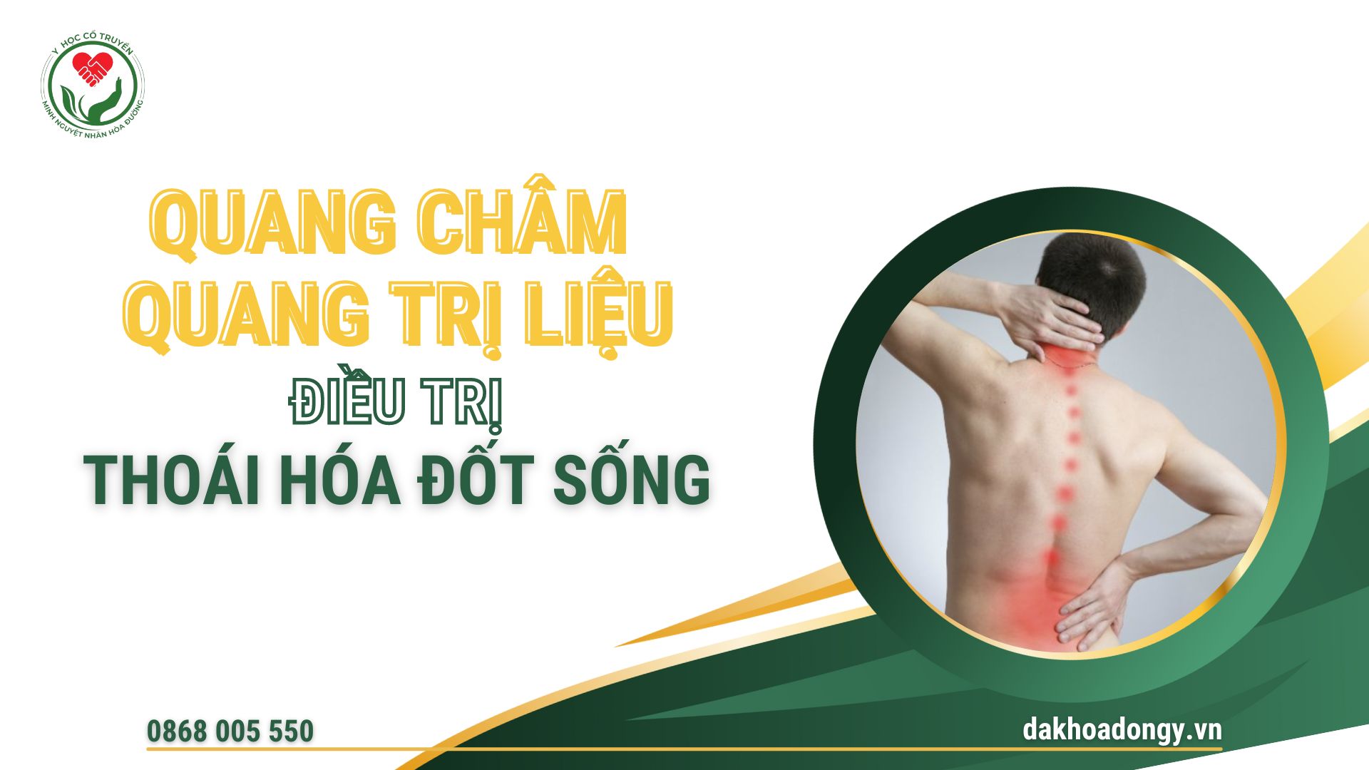 Quang châm Quang trị liệu điều trị Thoái hóa đốt sống