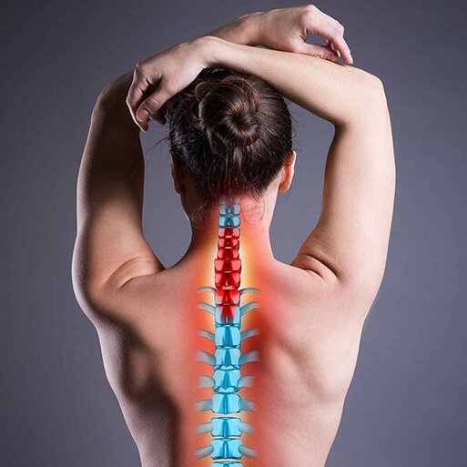 Thoát vị đĩa đệm cột sống cổ